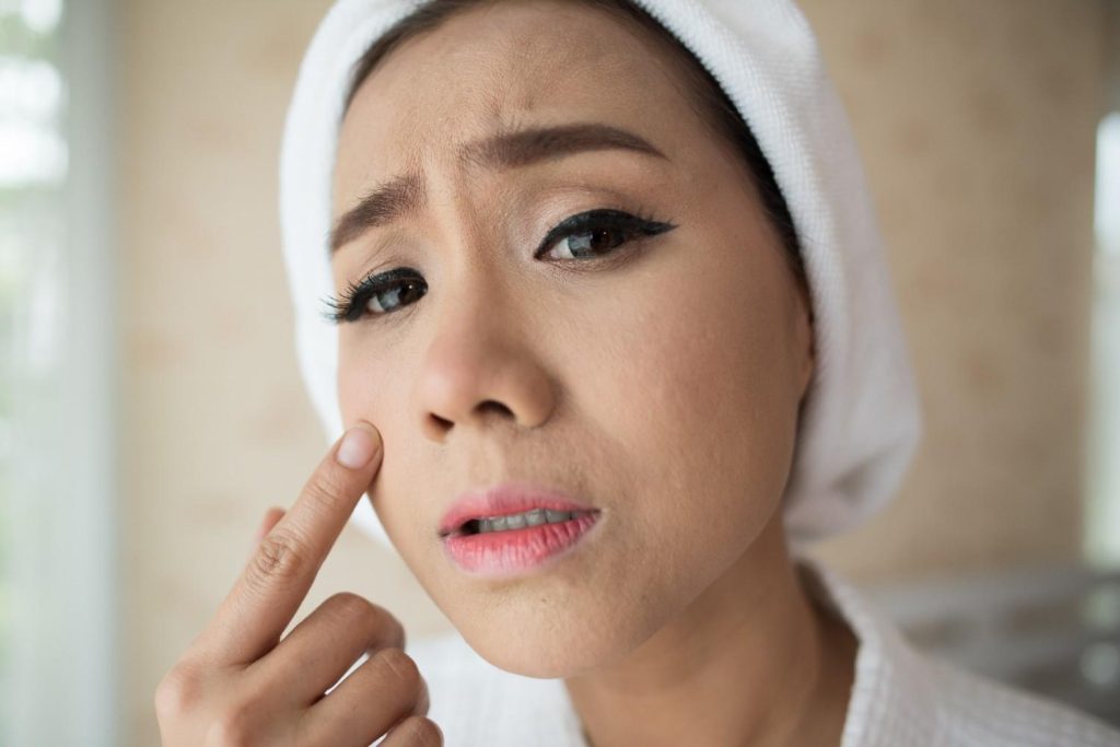 Makeup Look Patchy on Dry Skin